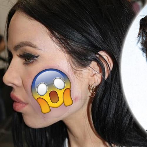 Aussie Girl Gets Harry Styles Tattooed On Her Face