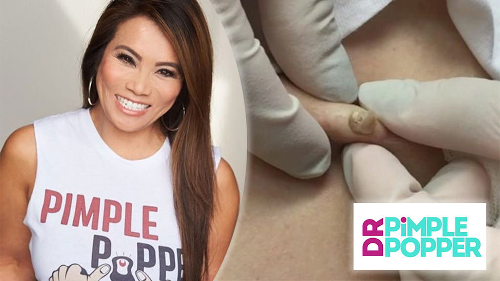 Dr Pimple Popper Is Coming To Tv & It Looks Amazing.