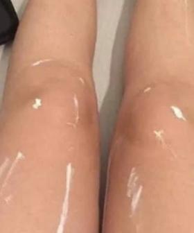 Why This Photo Of A Pair Of Legs Is Absolutely Doing Our Heads In