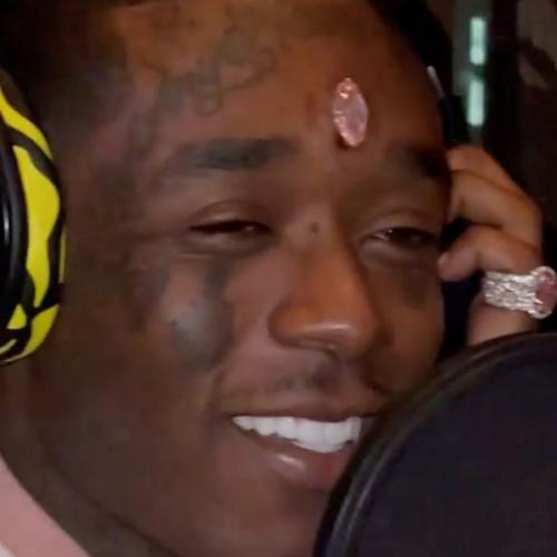 Rapper Gets A $24 MILLION Diamond Implanted In His FOREHEAD!