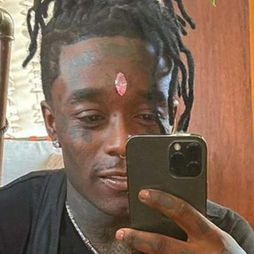 Rapper Has $32 Million Diamond Ripped Out of His Forehead During Concert