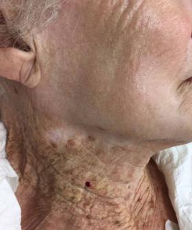 This Pic Of A 92-Year-Old Woman’s Neck Is One Helluva Reminder To Slap On SPF