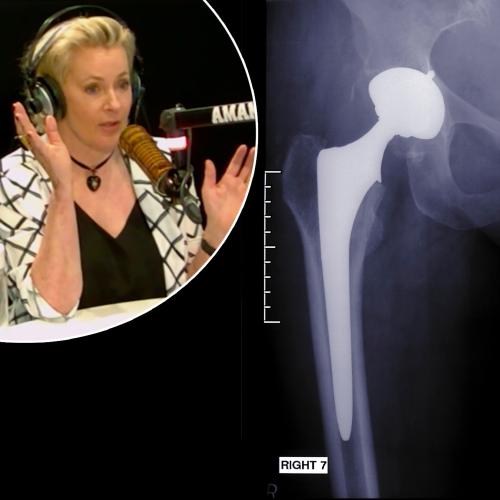 Amanda Keller Opens Up About Having A Hip Replacement At Just 49