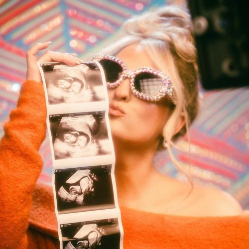 Meghan Trainor Announced She's Pregnant With Baby #2!